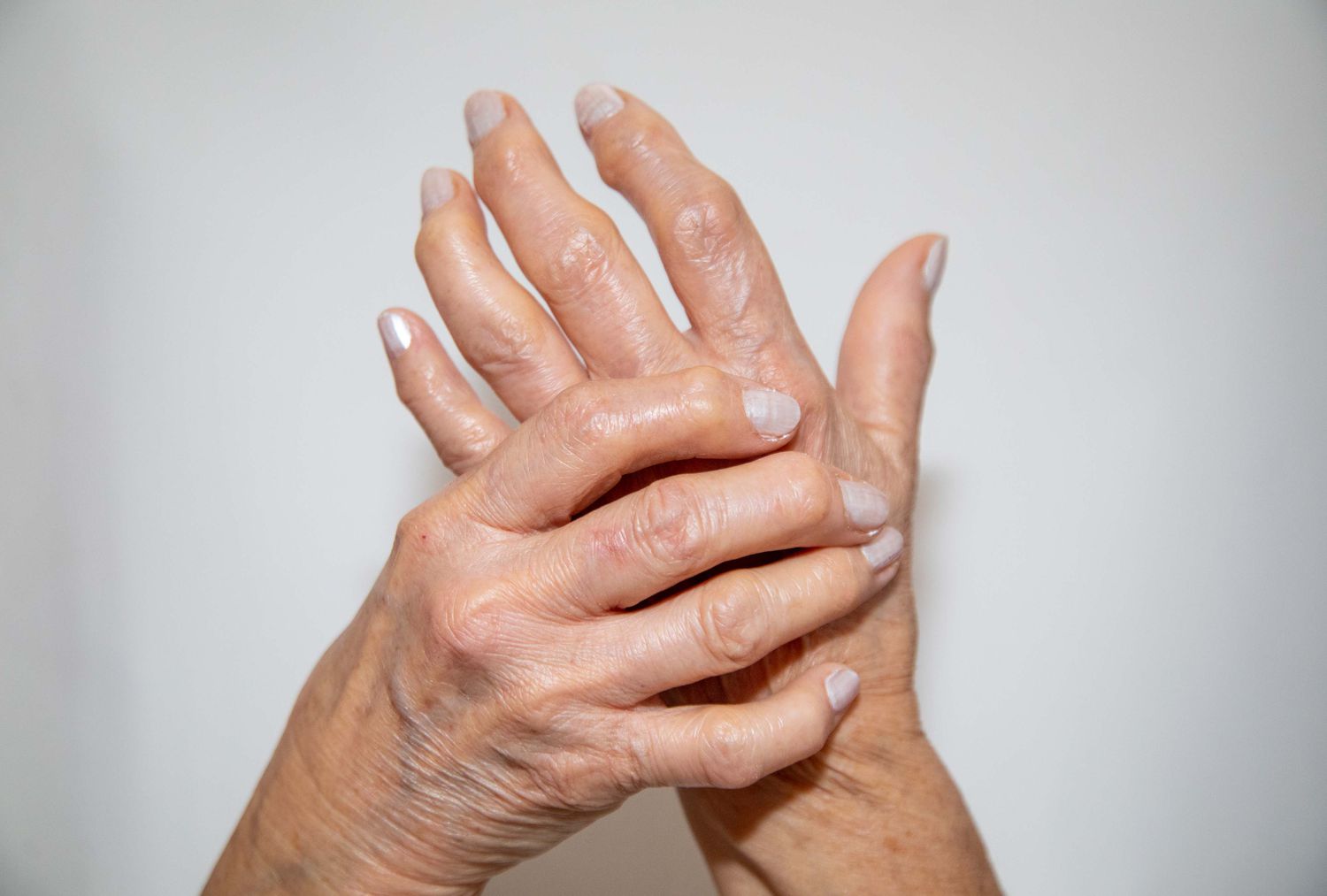 arthritis 2.jpg